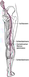 Ischias