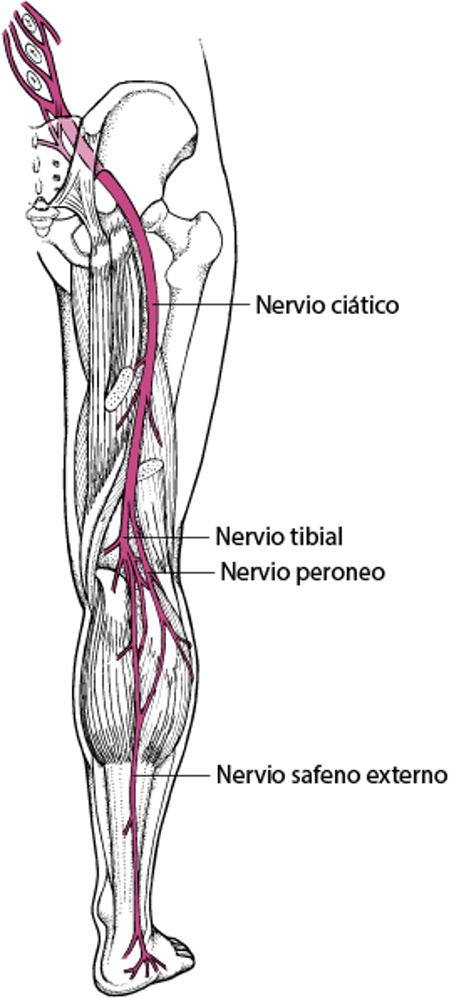 Ciática