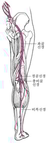 좌골신경통
