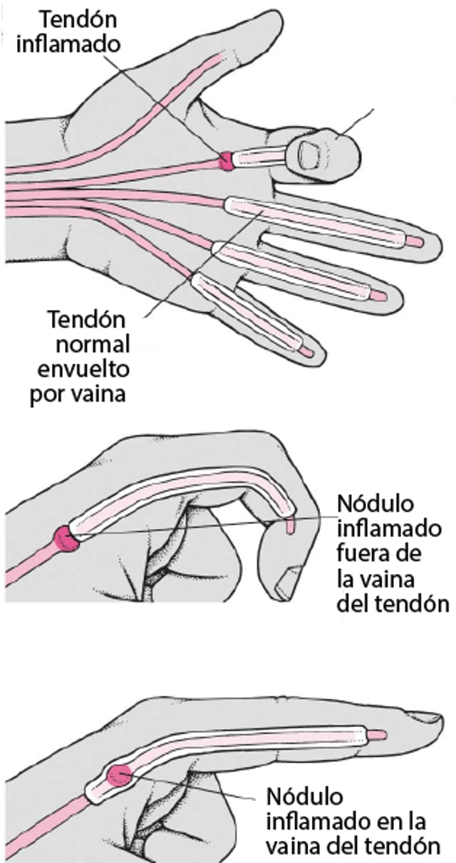 Posición de dedo en gatillo