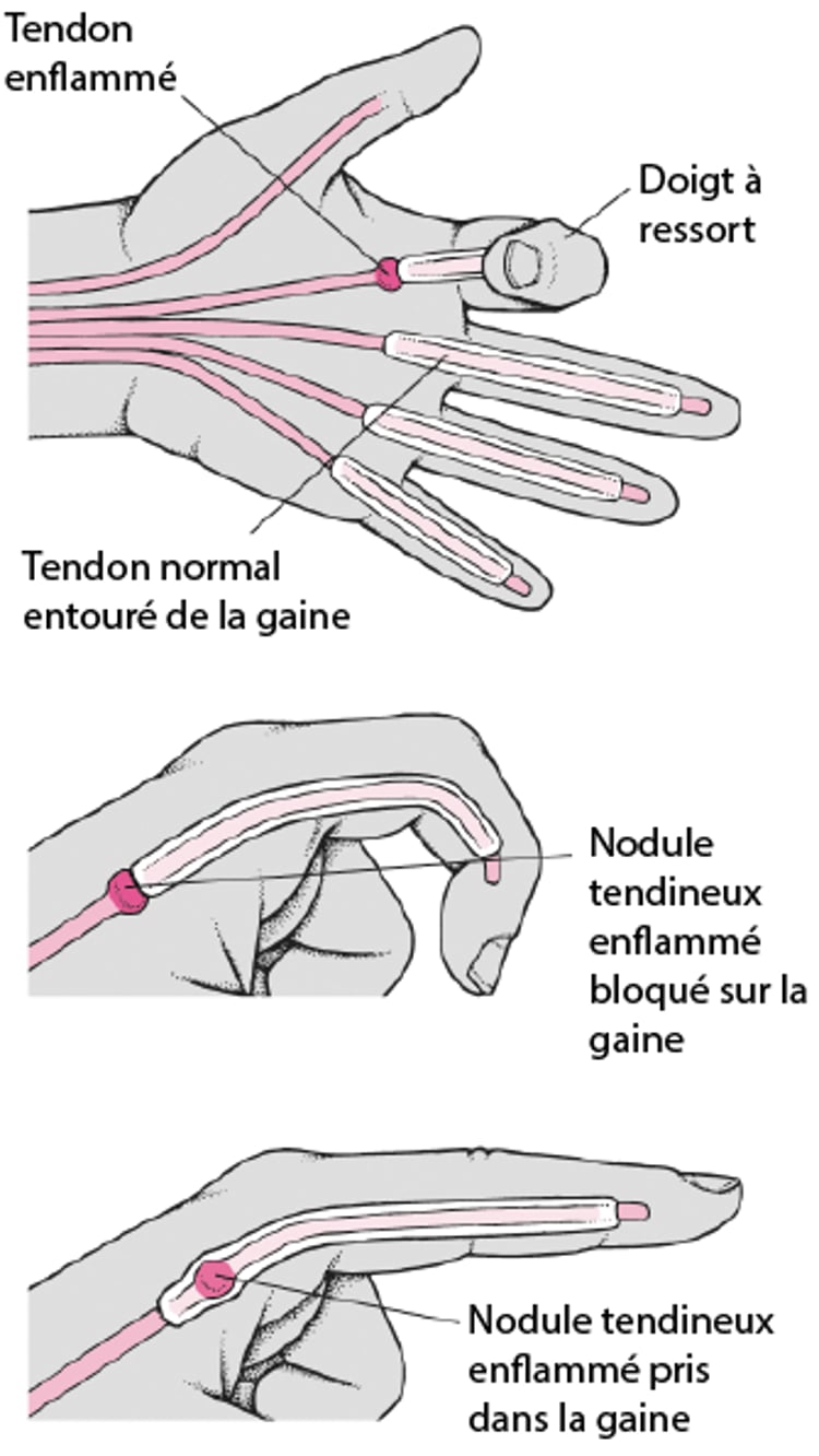 Position des doigts à ressaut