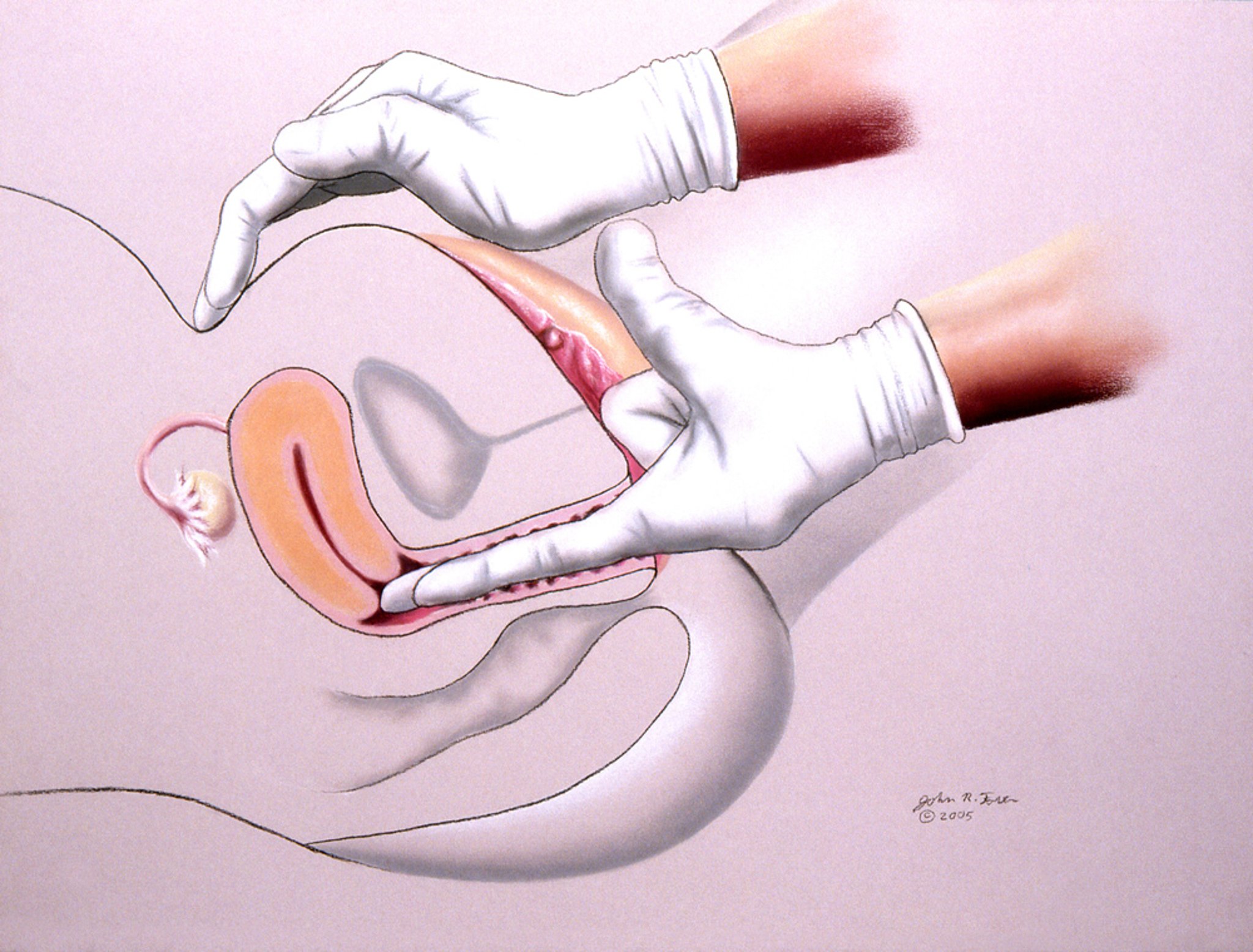 Uchunguzi wa Fupanyonga