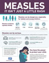 Measles Fact Sheet