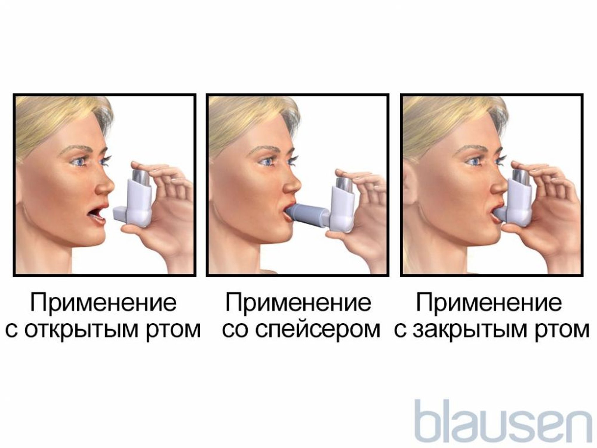 Дозирующий ингалятор