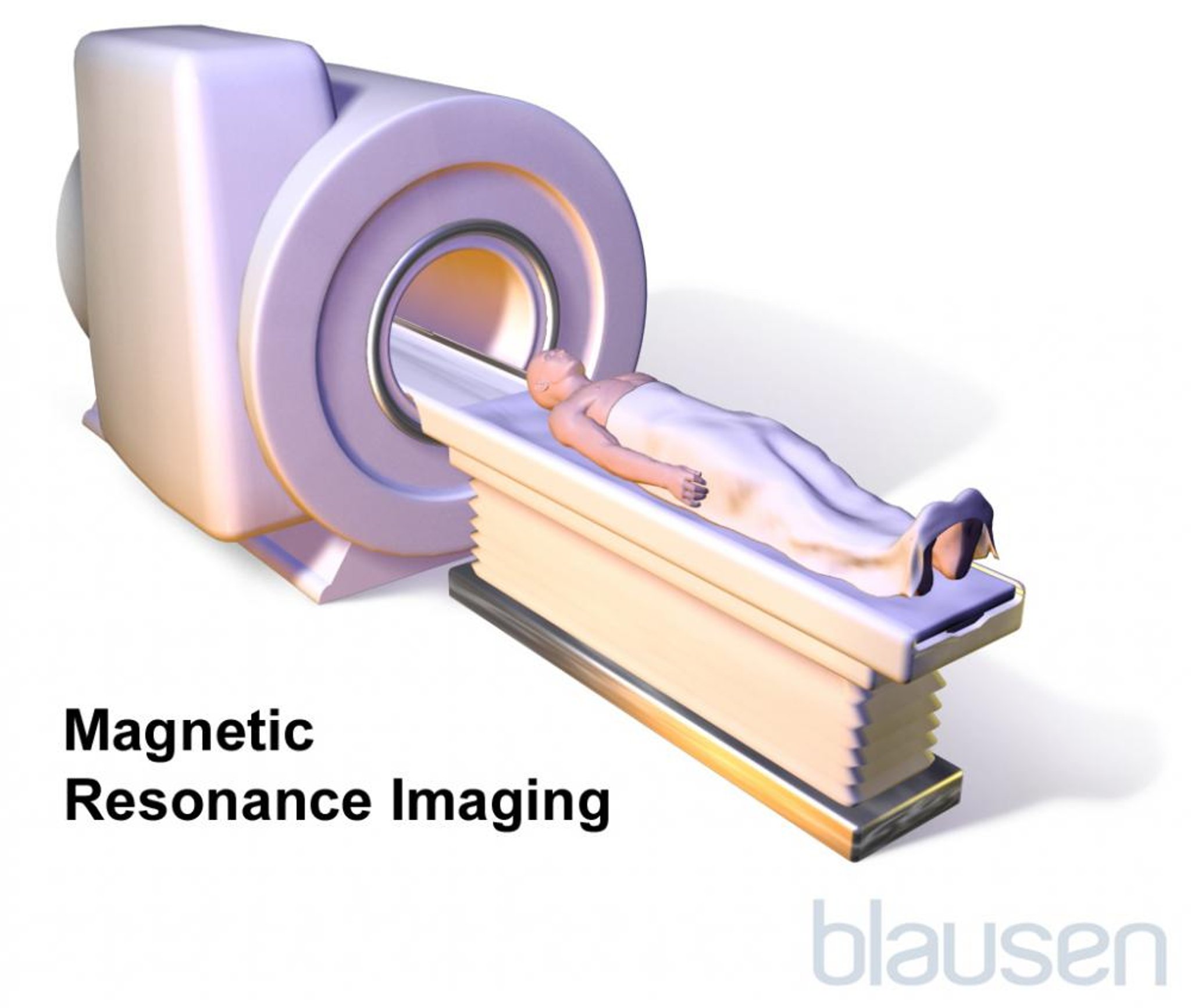 Risonanza magnetica per immagini (RMI)