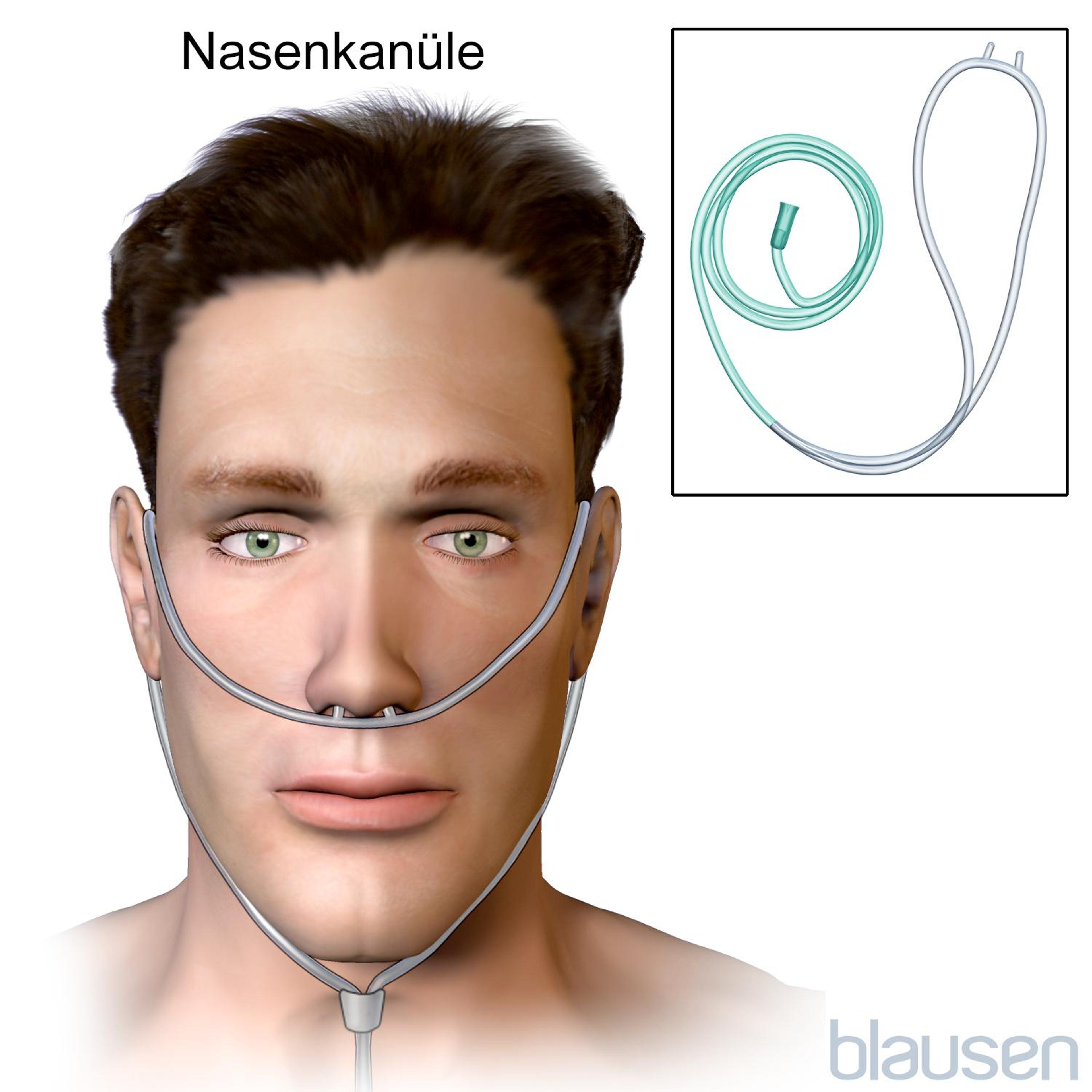 Nasenkanüle