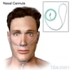 Cánula nasal