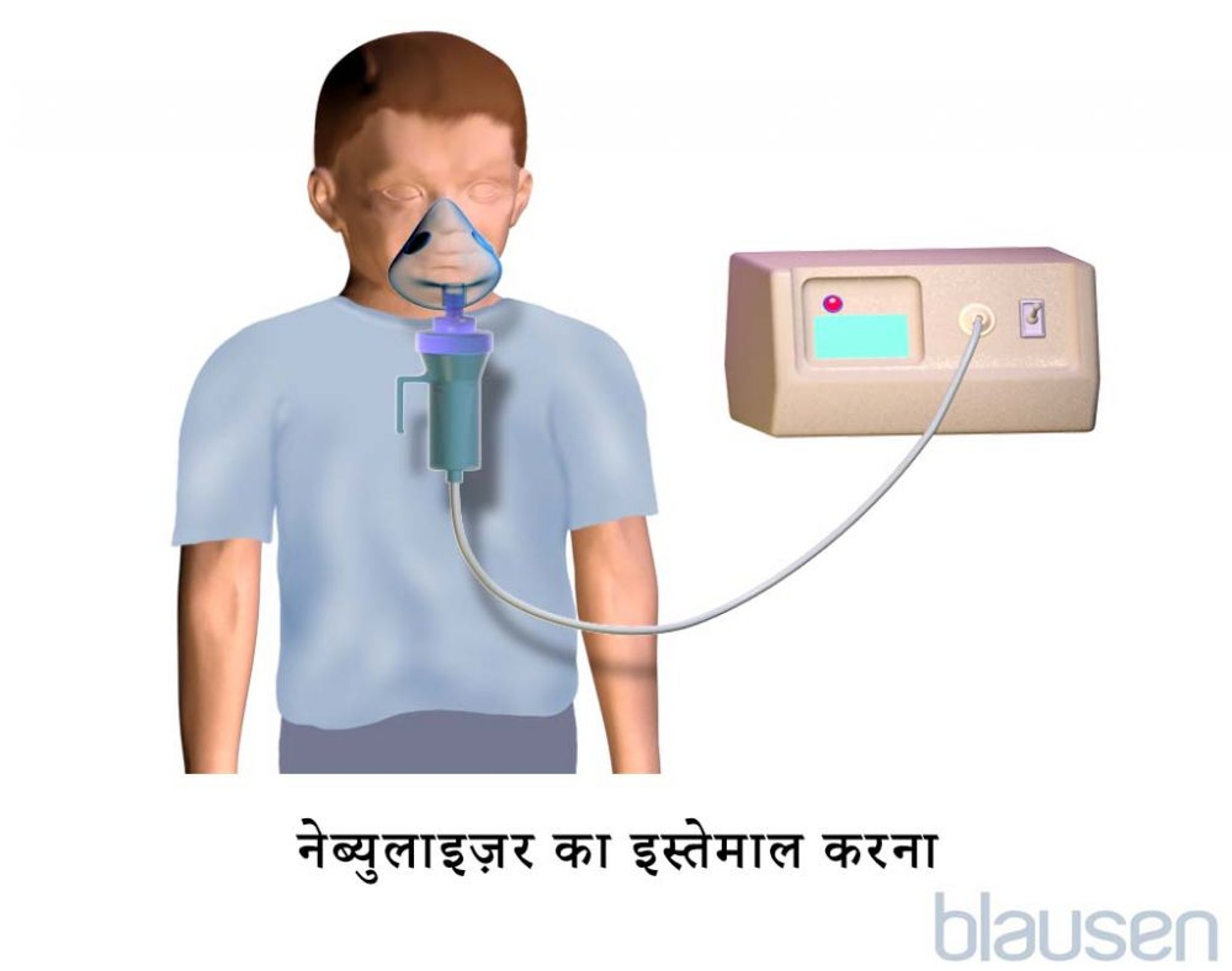 बच्चे के लिए नेबुलाइज़र मास्क