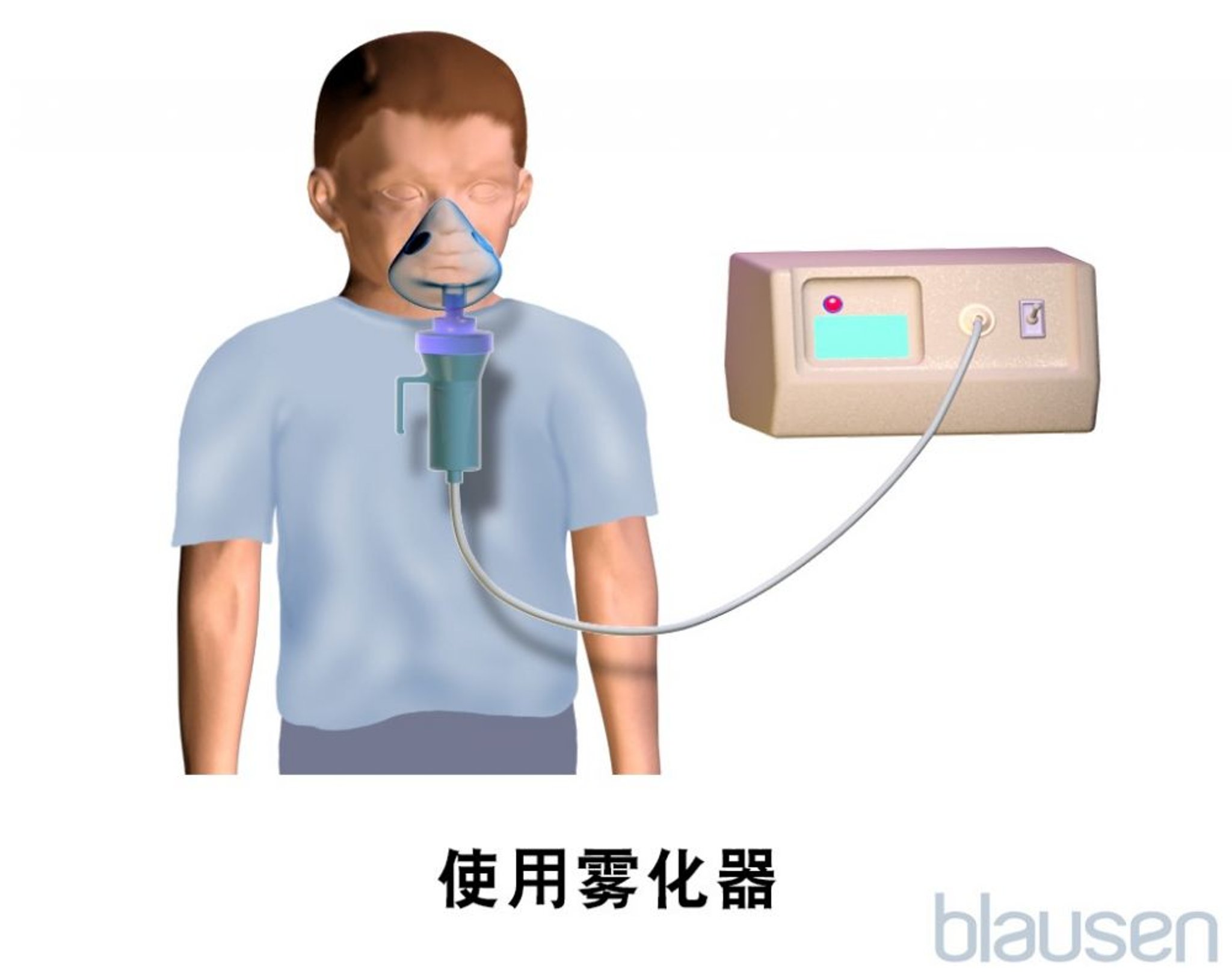 儿童雾化器面罩