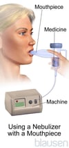 Nebulizer With a Mouthpiece
