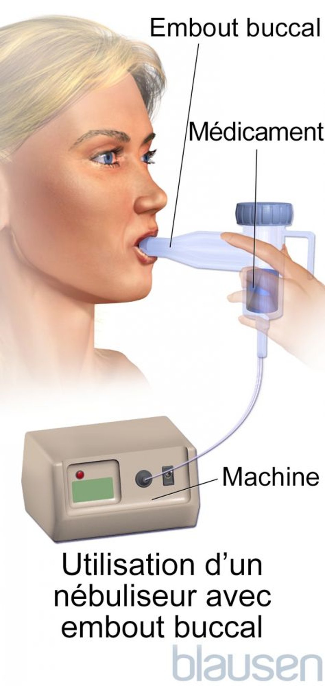 Nébuliseur à embout