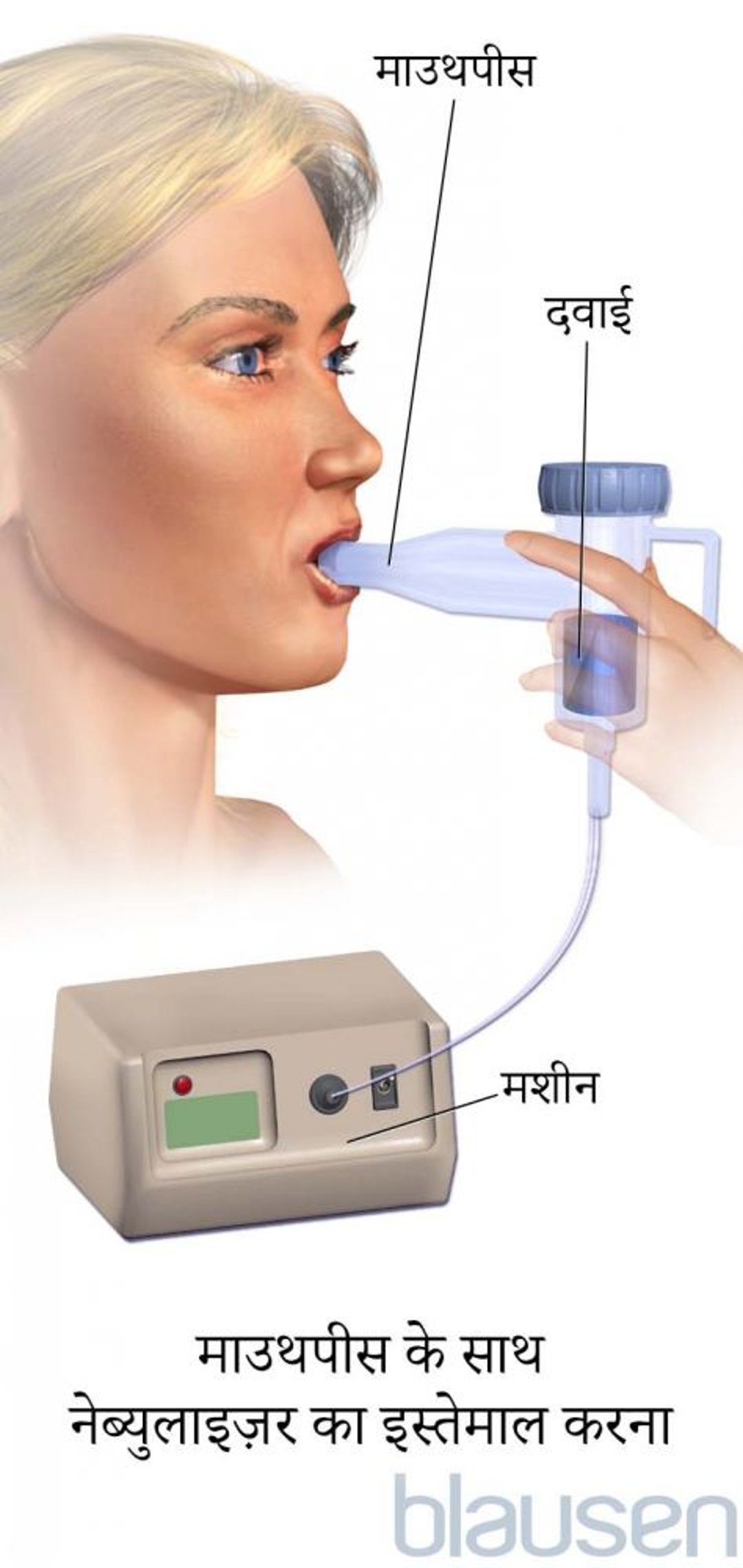 माउथपीस के साथ नेब्युलाइज़र