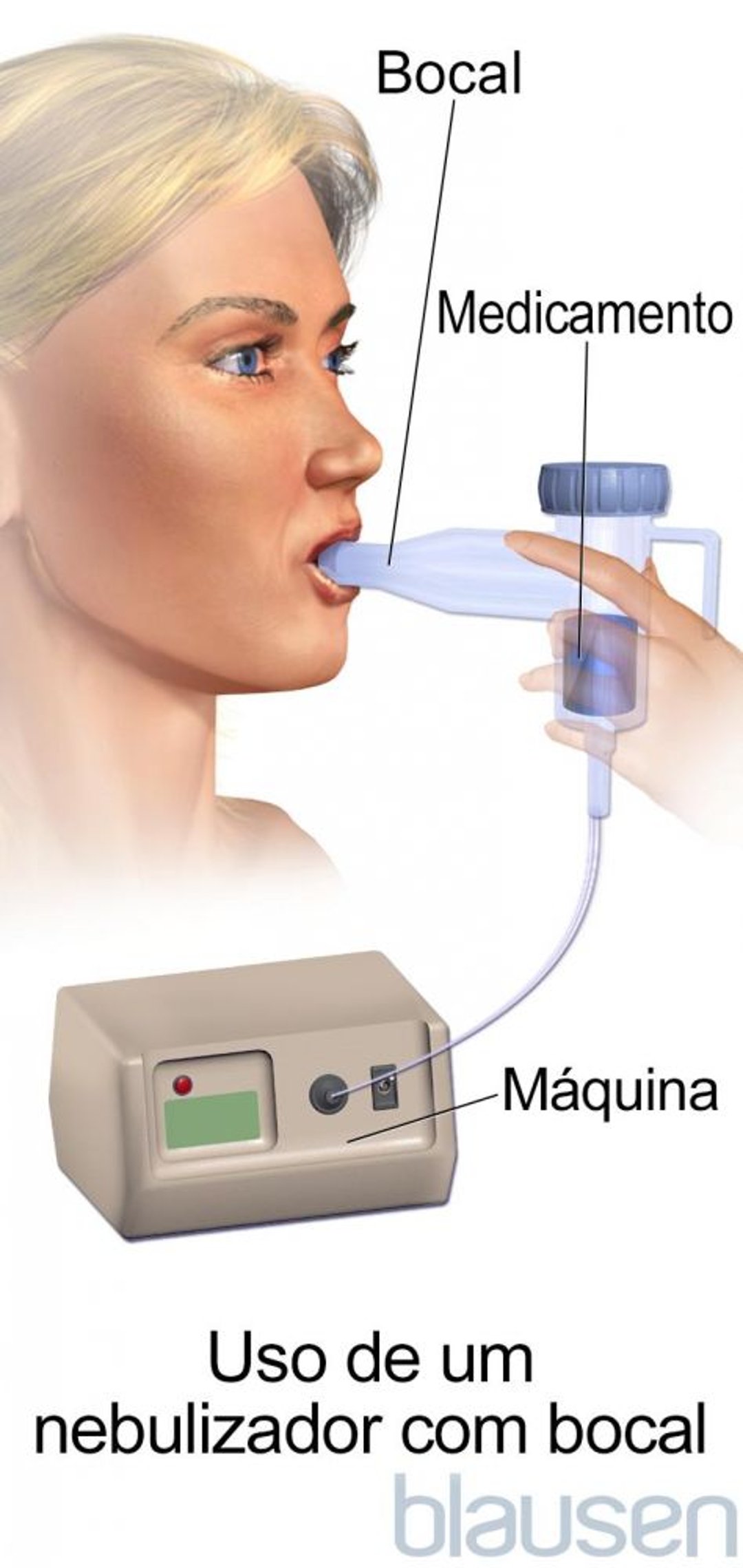 Nebulizador com bocal