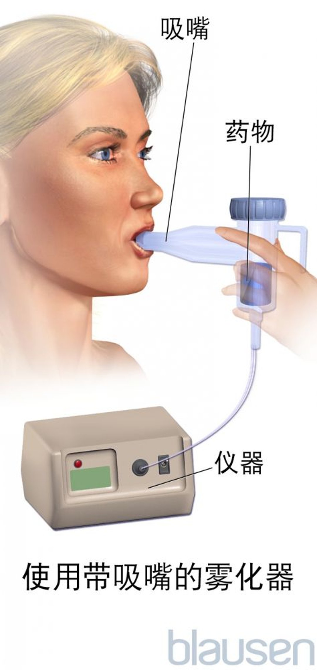 带吸嘴的雾化器
