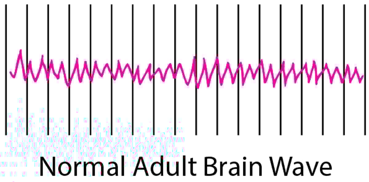 Recording Brain Activity