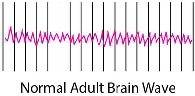 Recording Brain Activity