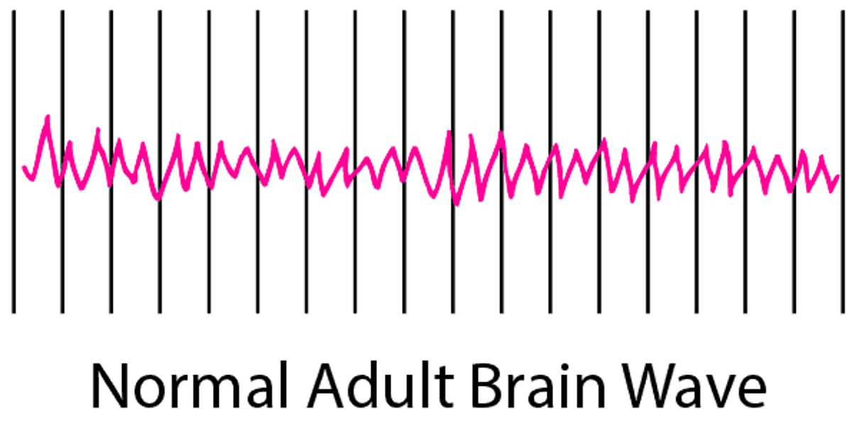 Recording Brain Activity