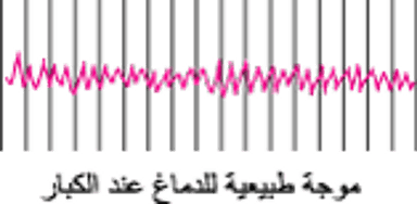 تسجيل نشاط الدِّماغ