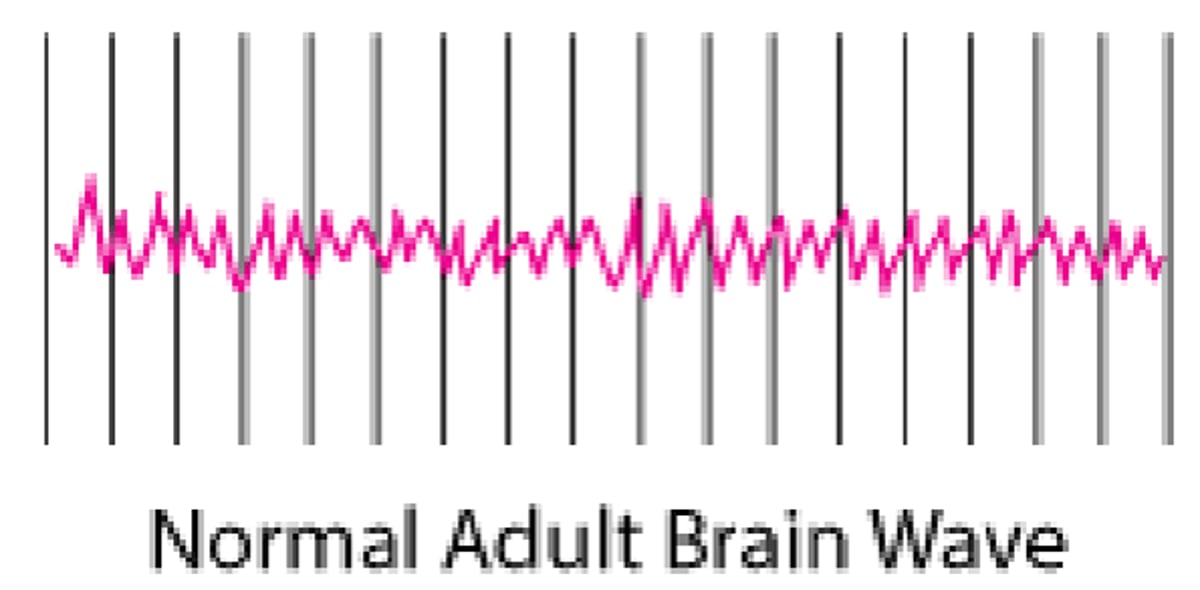 Registro de la actividad encefálica