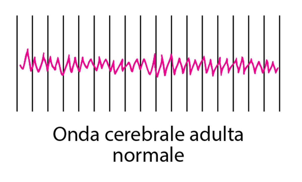 Registrazione dell’attività cerebrale