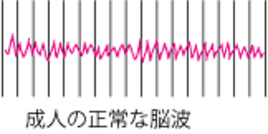 脳の活動の記録
