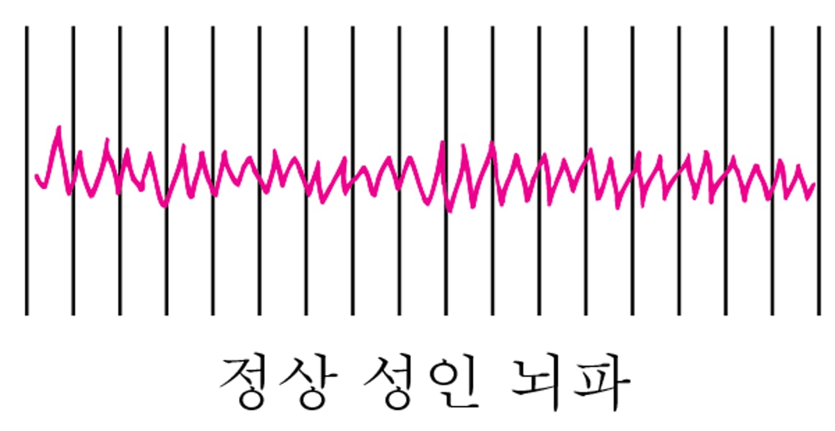 뇌 활동 기록