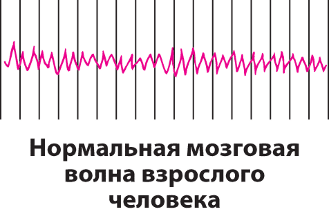 Регистрация активности головного мозга