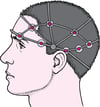 EEG