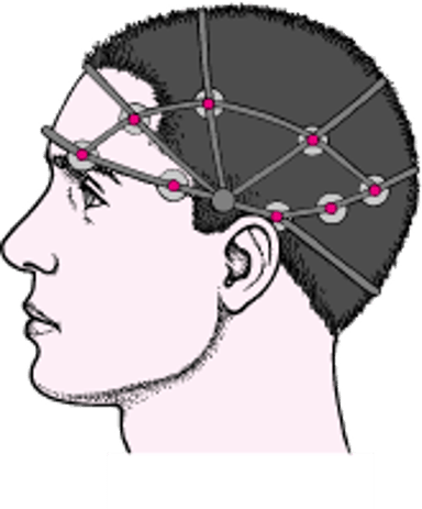 تخطيط كهربية الدماغ EEG