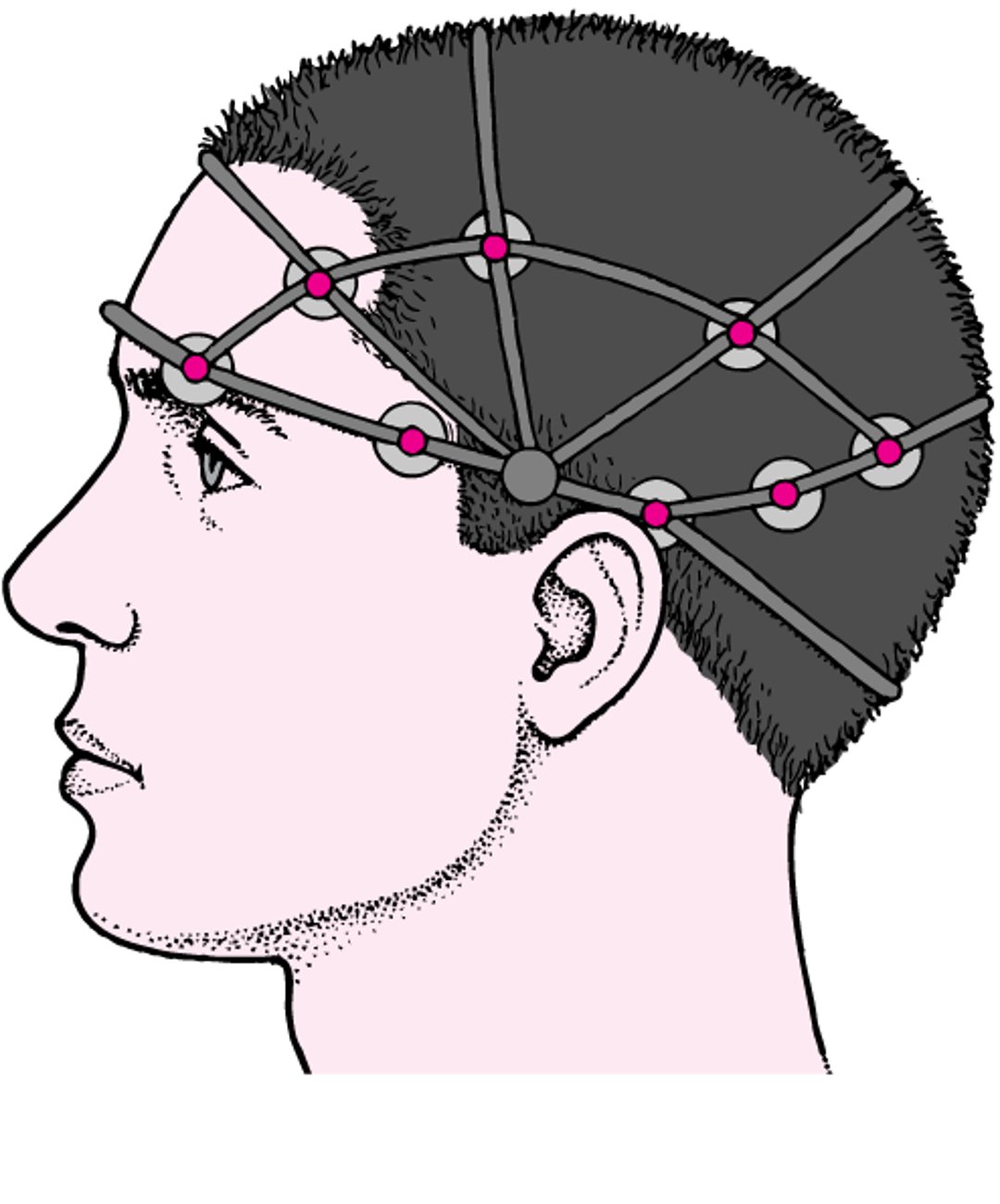 Electroencefalografía (EEG)