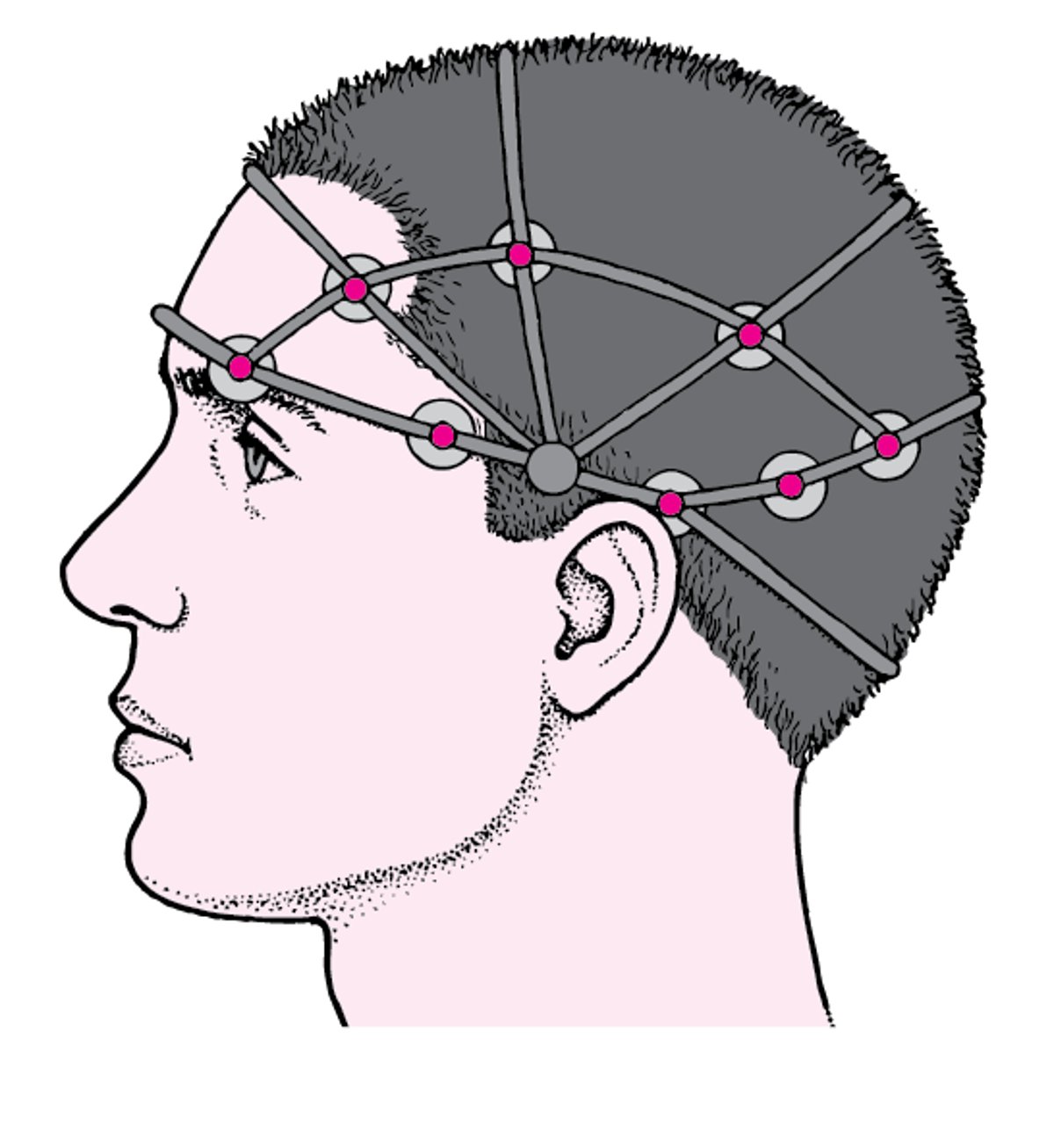 EEG