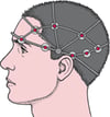 EEG