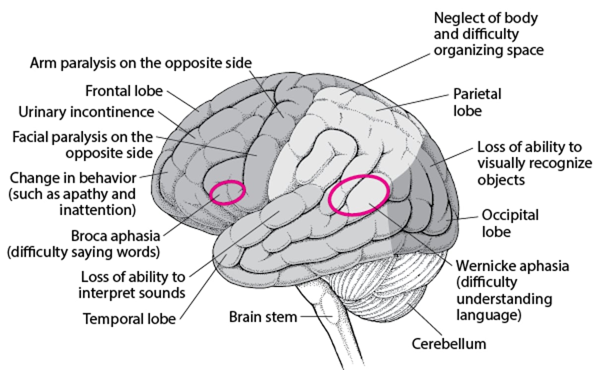 When Specific Areas of the Brain Are Damaged