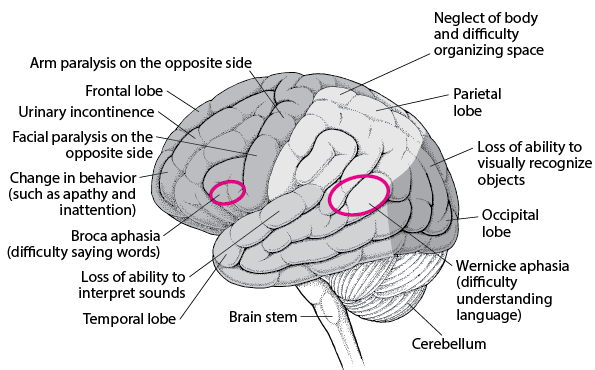 Overview of Brain Dysfunction - Brain, Spinal Cord, and Nerve Disorders ...