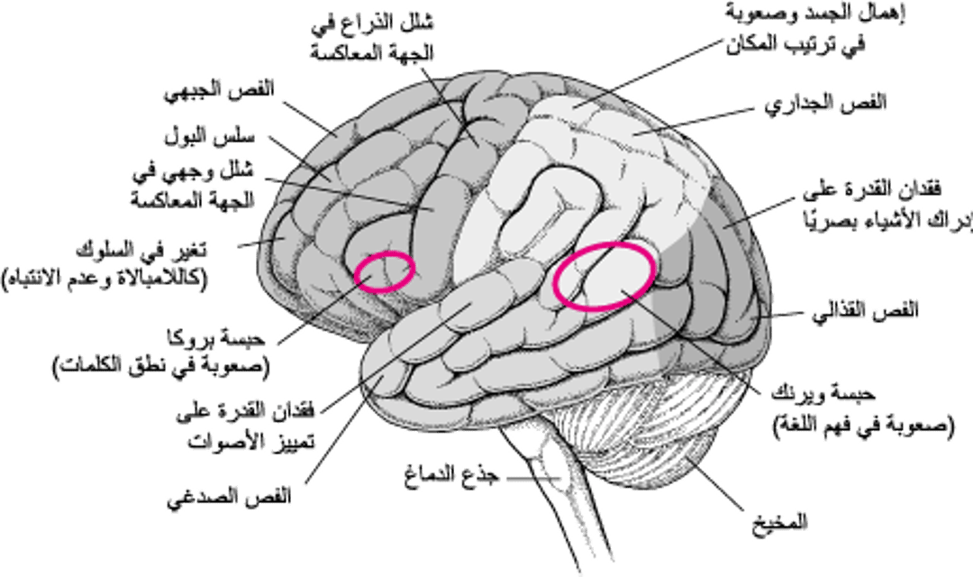 عواقب تضرر مناطق معينة من الدماغ