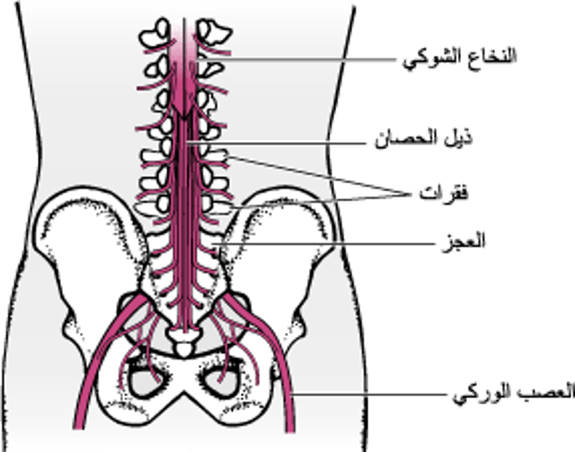 مُتَلاَزِمَةُ ذيل الفَرَس