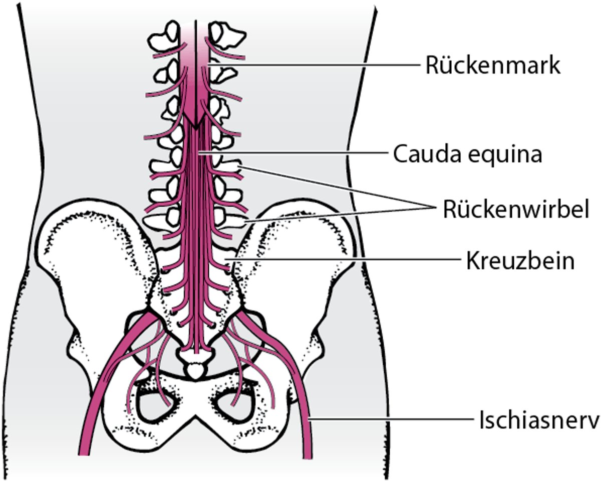 Kauda-Syndrom