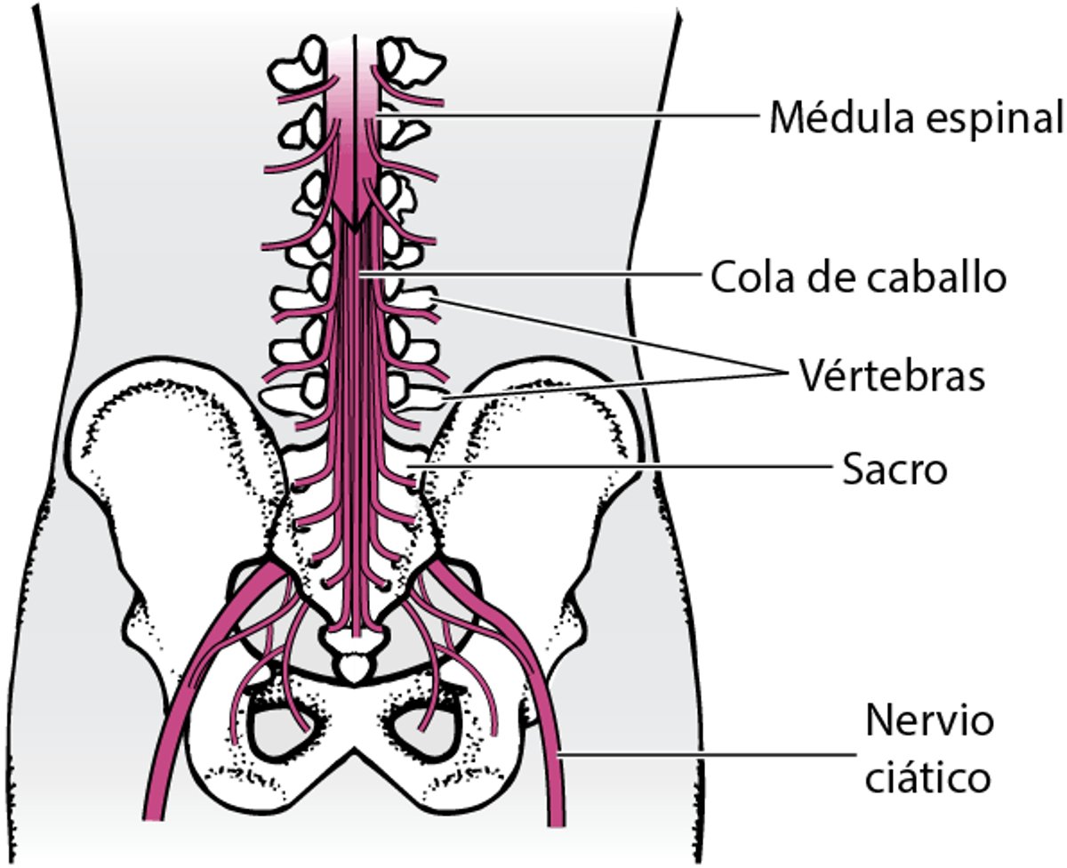 Síndrome de la cola de caballo