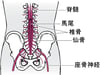 馬尾症候群