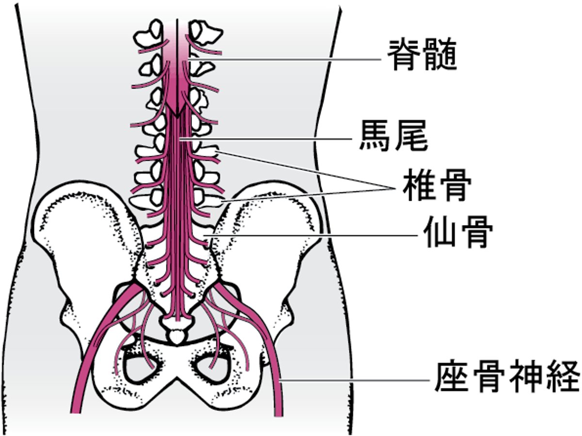 馬尾症候群