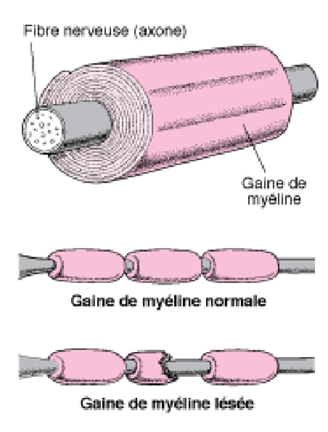 Isolation d’une fibre nerveuse