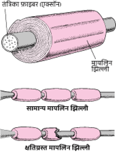 तंत्रिका तंतु को इन्सुलेट करना