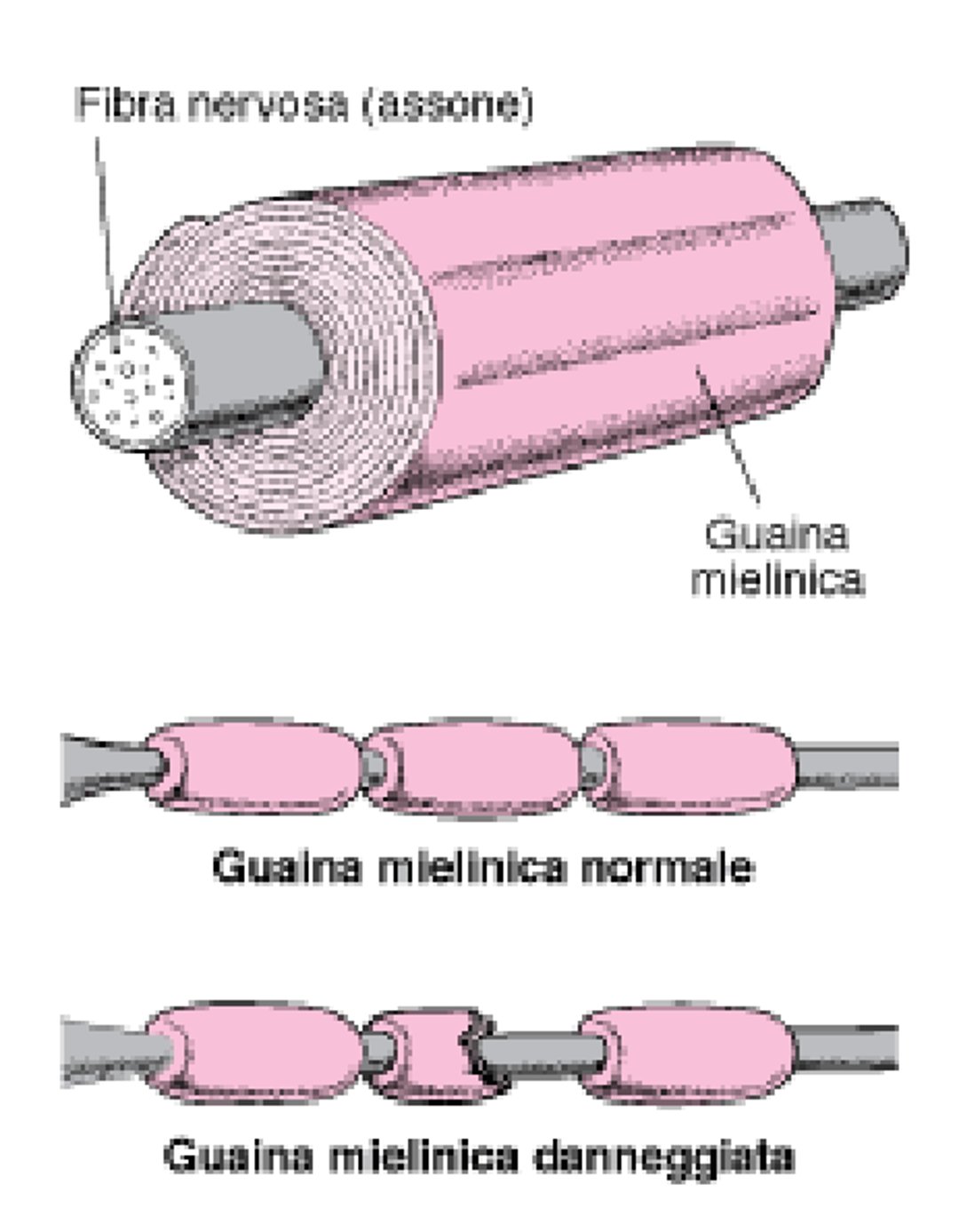 Isolamento di una fibra nervosa