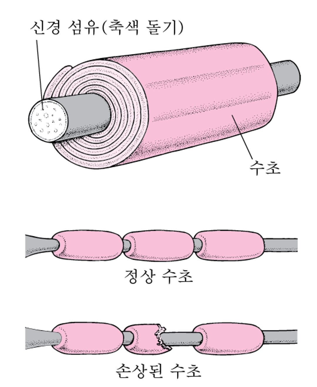 신경 섬유 절연