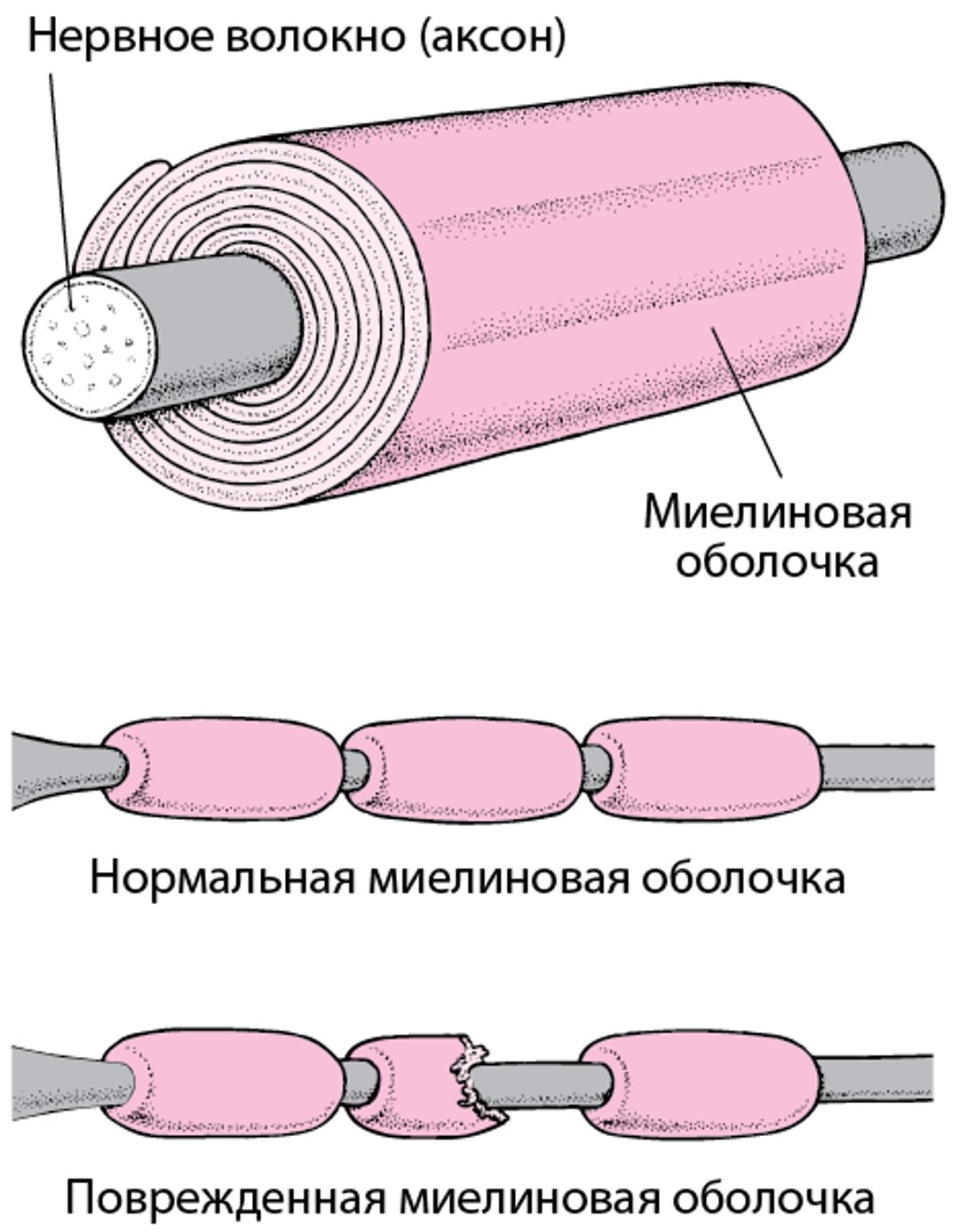 Изоляция нервного волокна