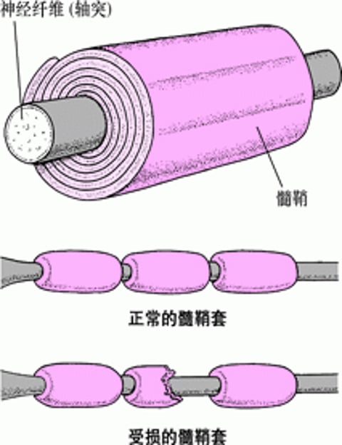 绝缘的神经纤维