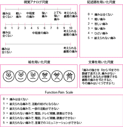 疼痛スケール：痛みの強さ