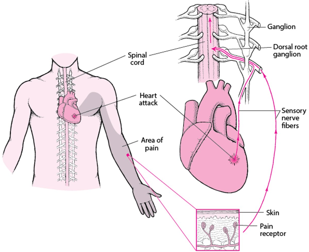 What Is Referred Pain?