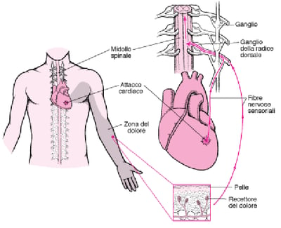 Cos’è il dolore riferito?