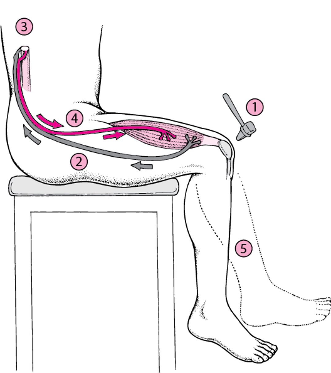 Reflex Arc: A No-Brainer